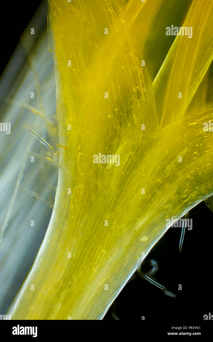 Vue microscopique d'pissenlit (Taraxacum officinale) détail de fleurs. La lumière polarisée, polariseurs croisés. Banque D'Images