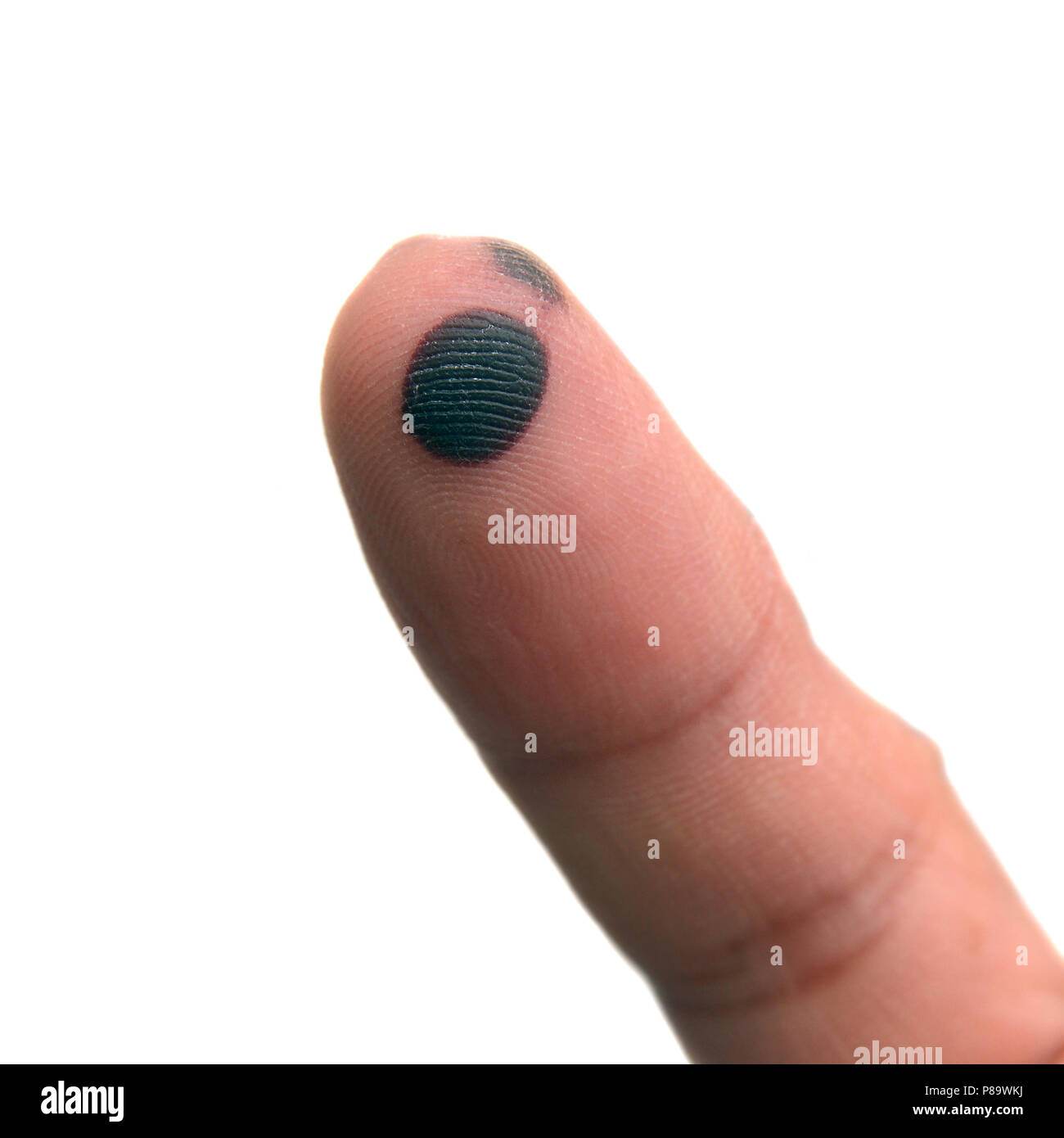 Un petit bleu sur le doigt Photo Stock - Alamy
