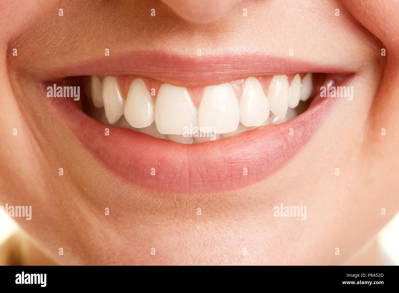 Ouvrir la bouche d'une jeune femme avec des dents blanches parfaites Banque D'Images