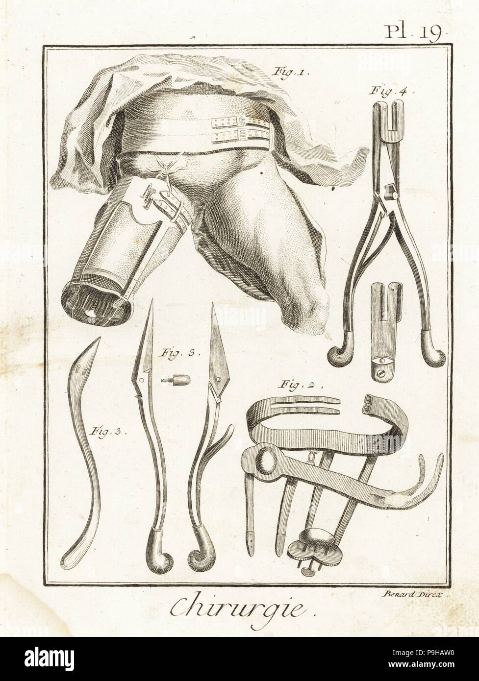 Jean Louis Petit's machine à comprimer l'artère fémorale au cours de l'amputation de la cuisse, 1 bandages 2 et 3 de l'aiguille de l'anévrisme, et ciseaux 4. La gravure sur cuivre par Robert Benard de Denis Diderot's Encyclopedia, Pellet, Genève, 1779. Banque D'Images Jean Louis Petit's machine à comprimer l'artère fémorale au cours de l'amputation de la cuisse, 1 bandages 2 et 3 de l'aiguille de l'anévrisme, et ciseaux 4. La gravure sur cuivre par Robert Benard de Denis Diderot's Encyclopedia, Pellet, Genève, 1779. Banque D'Images