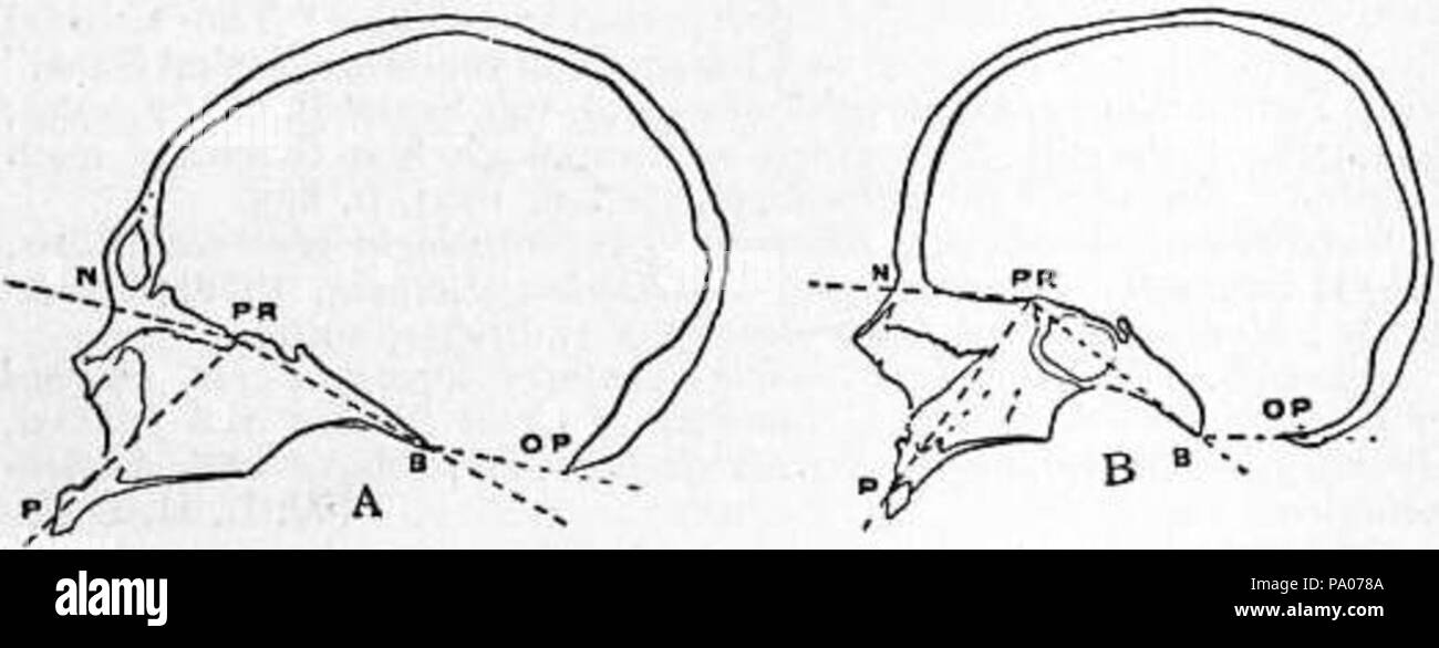 602 EB1911 Craniometry - Fig. 3-crânien angles, Guinée native (mâle) ; femme européenne Banque D'Images