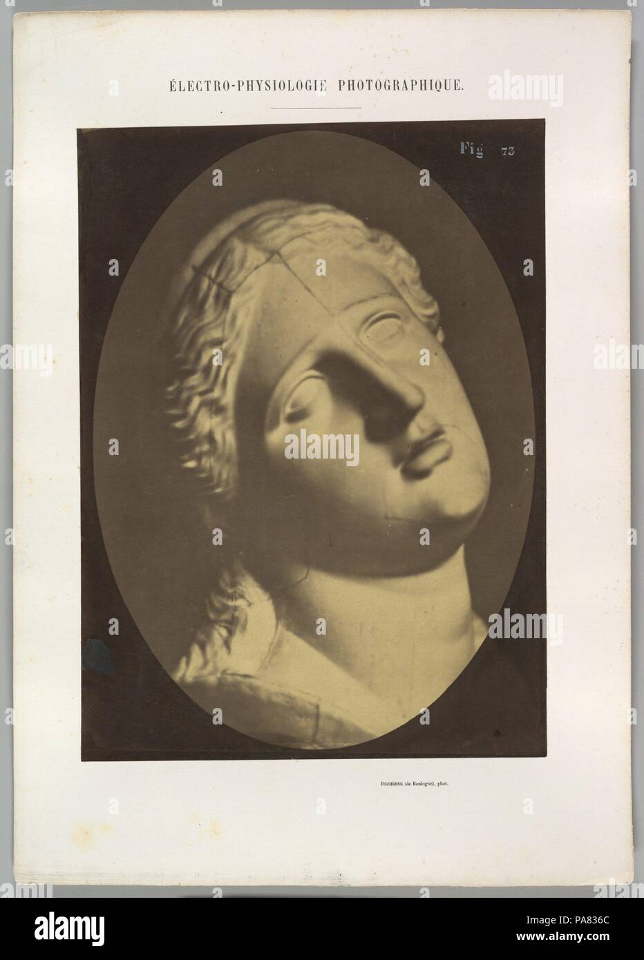Figure 73 : La tête de Niobé. Artiste : Guillaume-Benjamin Duchenne de Boulogne-Amand (Français, 1806-1875), Adrien Tournachon (Français, 1825-1903). Dimensions : Image (ovale) : 28,6 × 20,4 cm (11 1/4 x 8 1/16 in.) Feuille : 29,2 × 21,5 cm (11 1/2 x 8 7/16 in.) : 40,1 × 28,3 Montage cm (15 13/16 × 11 1/8 in.). Date : 1856, imprimé en 1862. Musée : Metropolitan Museum of Art, New York, USA. Banque D'Images