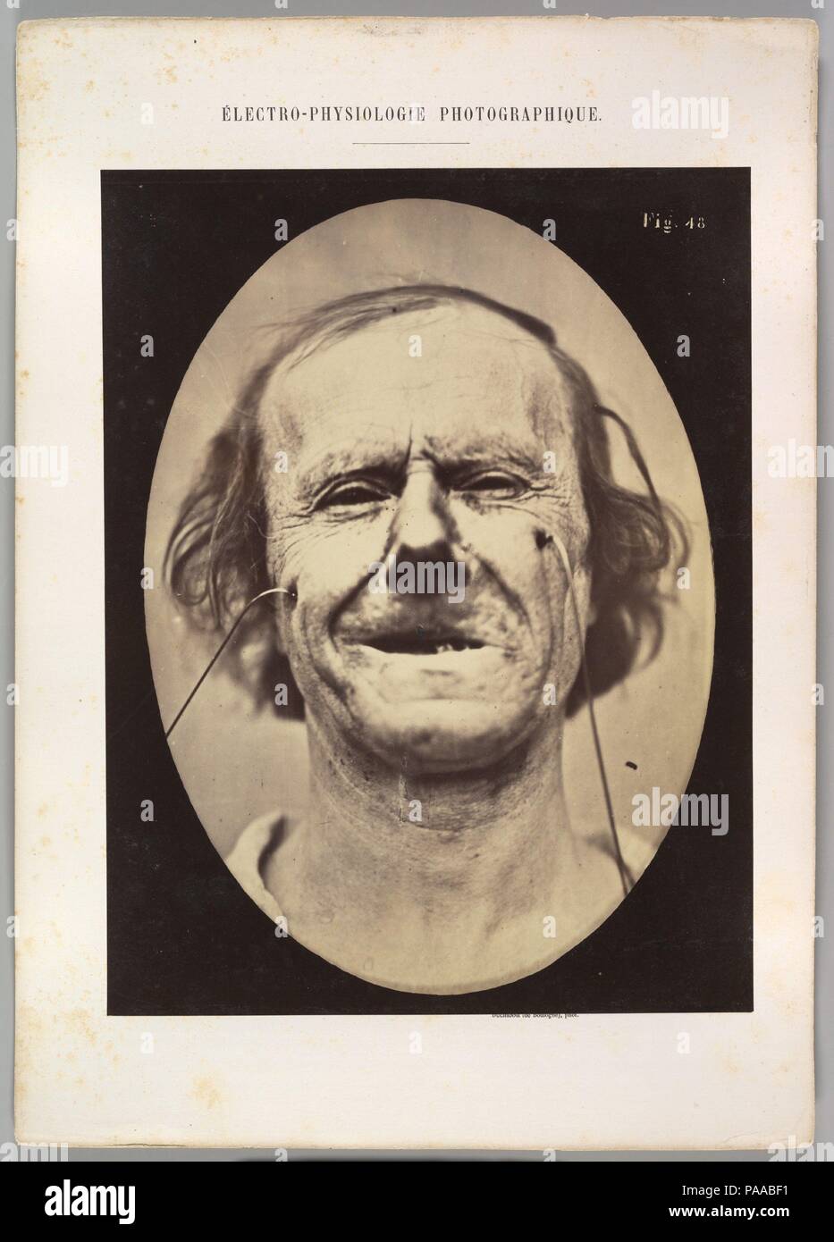 Figure 48 : Légère en pleurant, pitié et faible faux rire. Artiste : Guillaume-Benjamin Duchenne de Boulogne-Amand (Français, 1806-1875), Adrien Tournachon (Français, 1825-1903). Dimensions : Image (ovale) : 28,5 × 20,4 cm (11 1/4 x 8 1/16 in.) Planche : 30,2 × 23,1 cm (11 7/8 x 9 1/8 in.) Mont : 40,2 × 28,5 cm (15 13/16 × 11 1/4 in.). Date : 1856, imprimé en 1862. Musée : Metropolitan Museum of Art, New York, USA. Banque D'Images