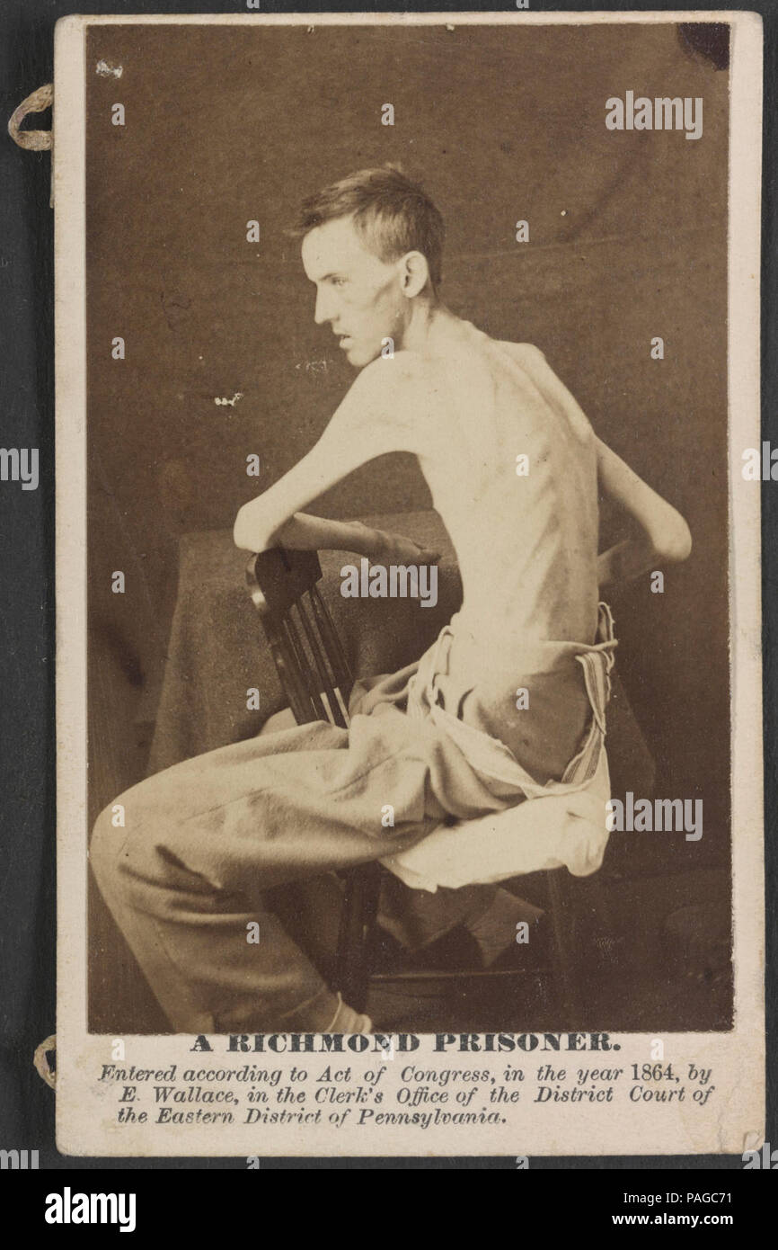 Un général américain prisonnier Richmond Hospital, Div. N° 1, Annapolis, Md., Jackson O. Broshears (c.-à-d. Brashears Co.), l'Indiana, d'infanterie à cheval. L'âge de 20 ans ; hauteur 6 pieds 1 pouces ; Banque D'Images