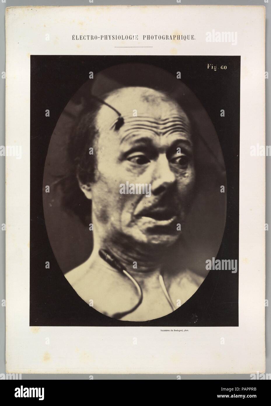 Figure 60 : la peur. Artiste : Guillaume-Benjamin Duchenne de Boulogne-Amand (Français, 1806-1875), Adrien Tournachon (Français, 1825-1903). Dimensions : Image (ovale) : 28,3 × 20,3 cm (11 1/8 x 8 in.) Feuille : 29,8 × 23 cm (11 3/4 x 9 1/16 in.) Mont : 40,2 × 28,5 cm (15 13/16 × 11 1/4 in.). Date : 1856, imprimé en 1862. Musée : Metropolitan Museum of Art, New York, USA. Banque D'Images