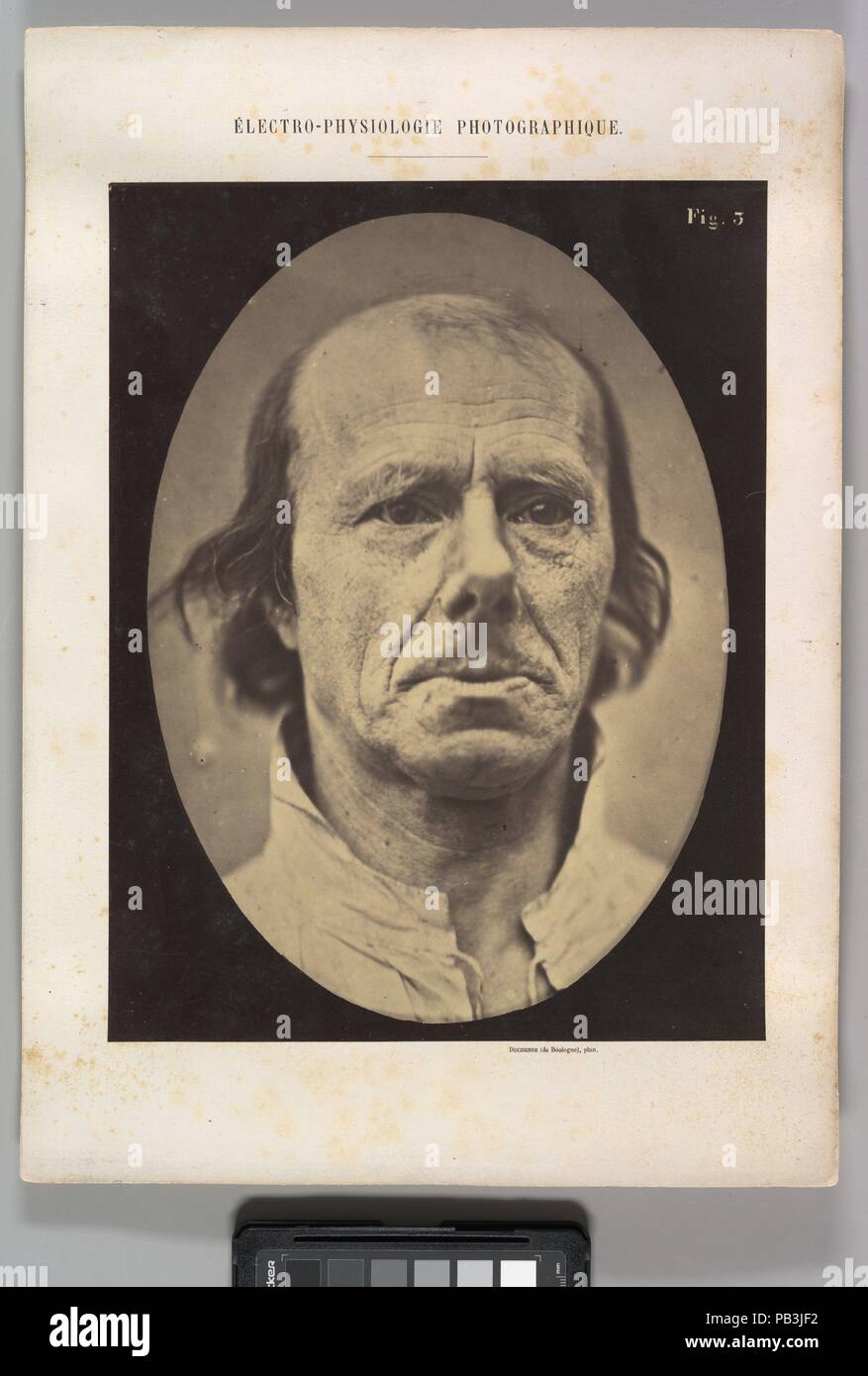 Figure 3 : le visage d'un vieil homme... photographié au repos. Artiste : Guillaume-Benjamin Duchenne de Boulogne-Amand (Français, 1806-1875), Adrien Tournachon (Français, 1825-1903). Dimensions : Image (ovale) : 28,3 × 20,3 cm (11 1/8 x 8 in.) feuille : 30 × 22,9 cm (11 13/16 x 9 in.) Mont : 40,1 × 28,4 cm (15 × 13/16 11 3/16 po.). Date : 1856, imprimé en 1862. Musée : Metropolitan Museum of Art, New York, USA. Banque D'Images