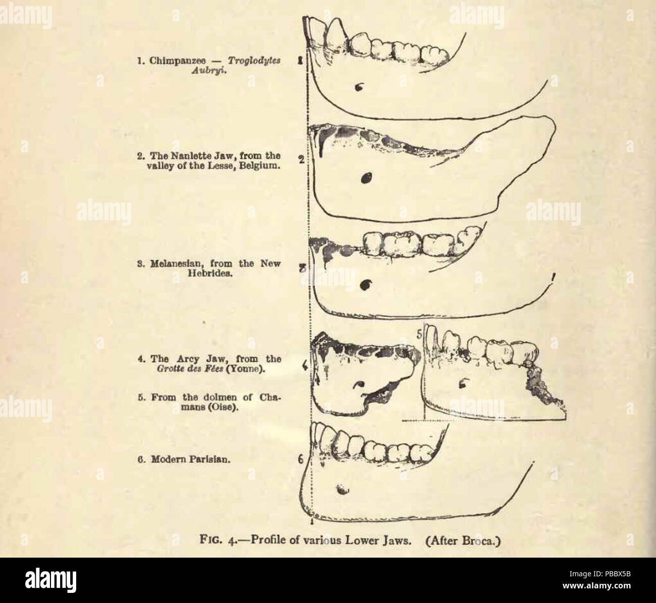 1150 P20-Fig.4 Profil de divers de la mâchoire inférieure (après Broca) Banque D'Images