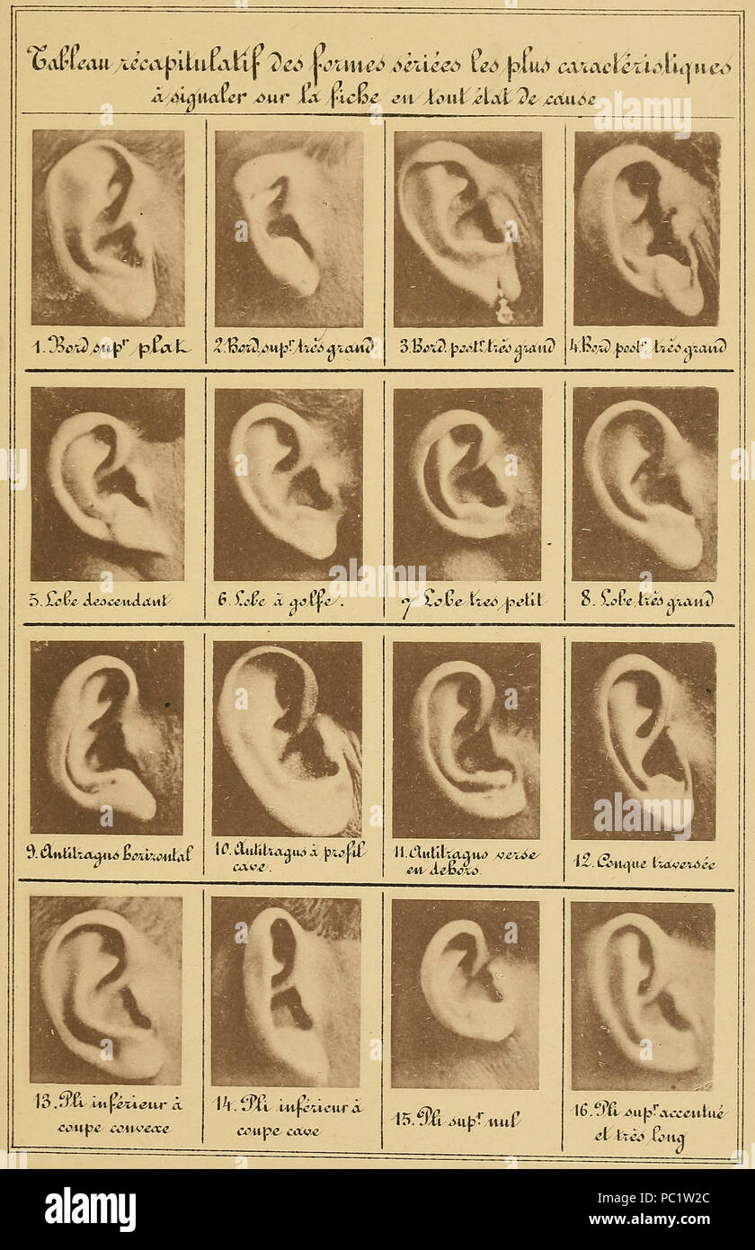 14 Bertillon - Identification anthropométrique (1893) 331 Banque D'Images