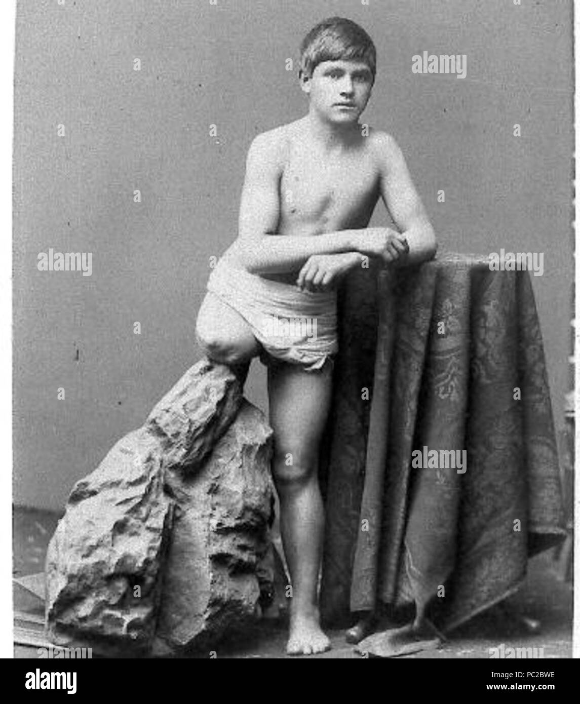 433 Mutilado en la PIB-1 Banque D'Images