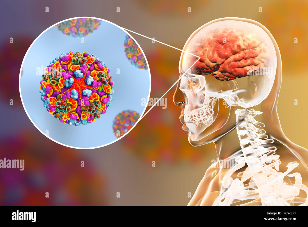 Les virus de l'encéphalite équine de l'infecter cerveau humain, illustration de l'ordinateur. C'est un ARN (acide ribonucléique) du virus du genre alphavirus. C'est un arbovirus (virus transmis par les arthropodes) et est transmis à l'homme, les oiseaux et les chevaux par piqûre de moustique. Les symptômes varient de légers symptômes semblables à ceux de l'inflammation du cerveau, un coma et la mort. Banque D'Images