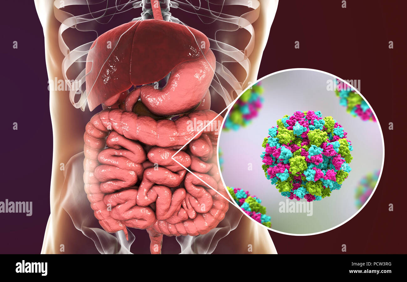 L'infection à norovirus, illustration de l'ordinateur. Le norovirus est un genre d'ARN (acide ribonucléique) virus (de la famille des Caliciviridae), qui sont responsables d'environ la moitié de tous les cas de gastro-entérite dans le monde entier. La maladie se caractérise par des nausées, vomissements, diarrhée et douleurs abdominales. La diarrhée résulte en une perte de liquide et de la déshydratation, qui peut entraîner la mort chez les jeunes, les personnes âgées et les personnes immunodéprimées si elle n'est pas traitée rapidement. Banque D'Images