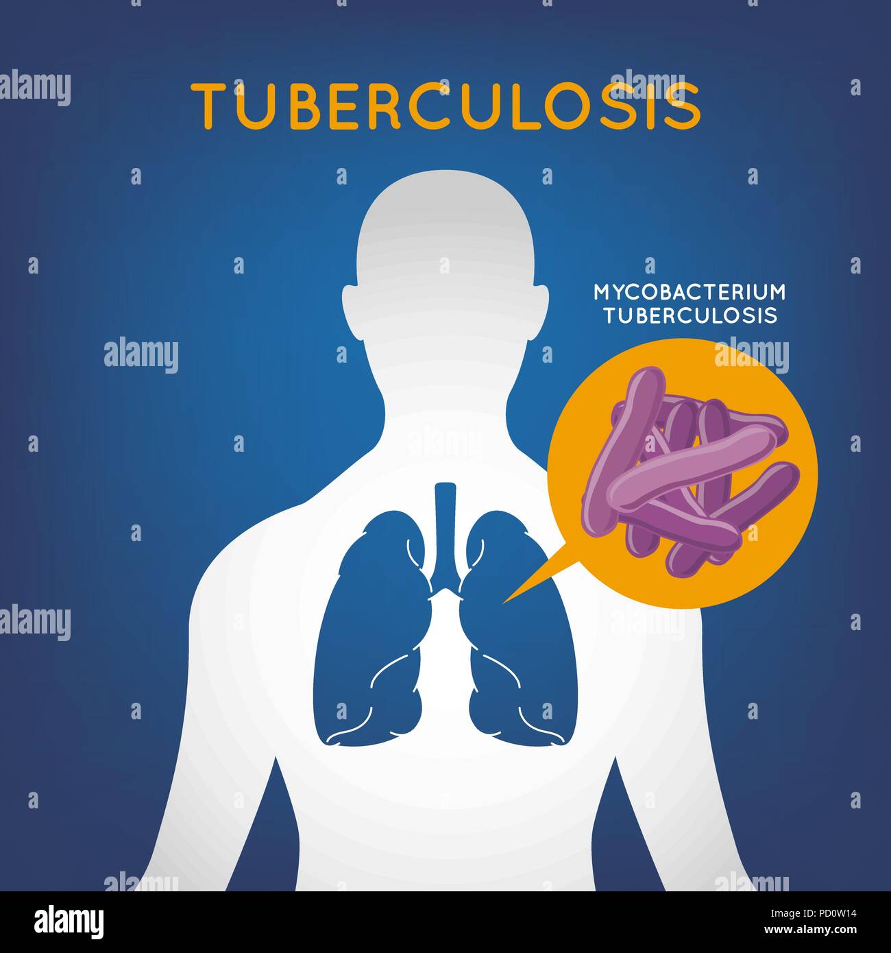La tuberculose l'icône logo vector illustration Illustration de Vecteur