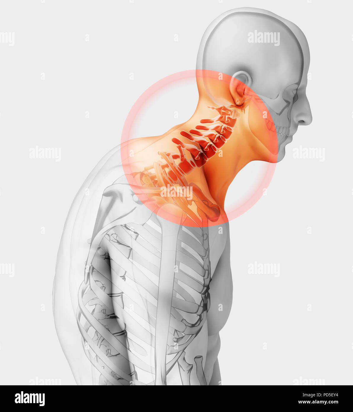 3D illustration, le cou douloureux - rachis cervical skeleton x-ray, medical concept. Banque D'Images