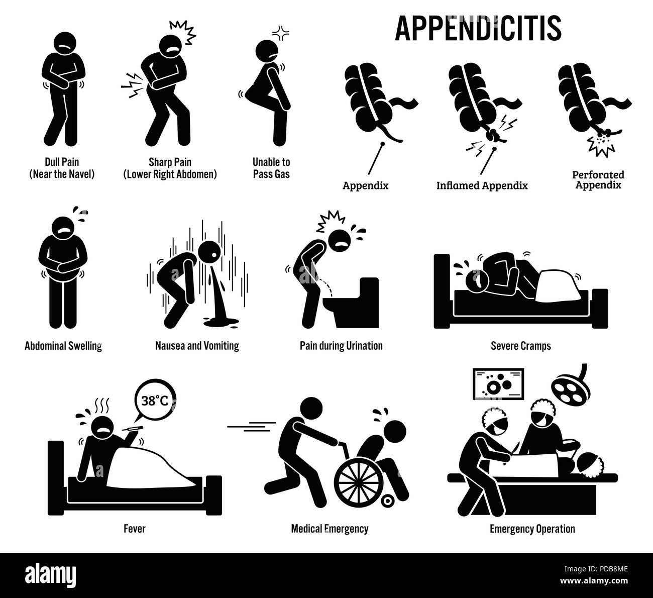 L'annexe et de l'appendicite d'icônes. Les pictogrammes et les diagrammes montrent les signes, symptômes, et la chirurgie d'urgence d'un patient en salle d'opération de l'appendicite. Illustration de Vecteur