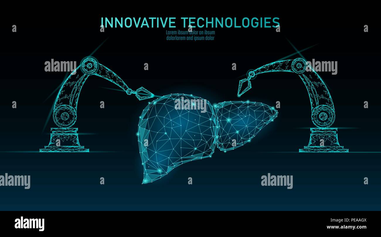 La chirurgie du foie robotique poly faible. Procédure de la chirurgie de l'hépatite polygonales. Bras du robot manipulateur. La science moderne médecine novatrice de la technologie d'automatisation. Rendu 3D forme triangle vector illustration Illustration de Vecteur