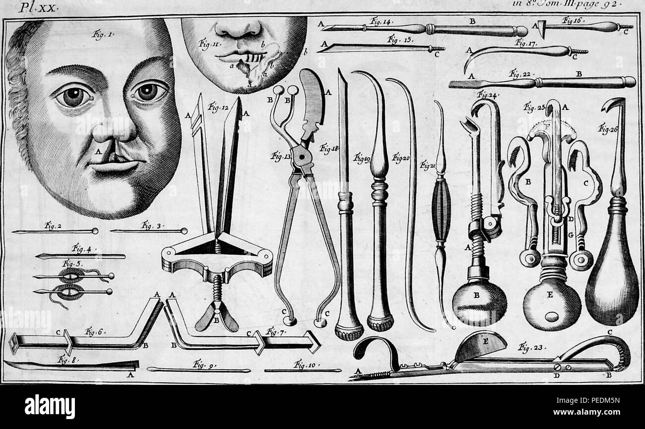 Illustration noir et blanc illustrant différents instruments utilisés pour la gomme et la chirurgie dentaire au cours de la dix-huitième siècle, depuis le volume "Institutions de Chirurgie" (institutions de la chirurgie) écrit par Lorenz Heister et François Paul, et publié dans Avignon à JJ Niel, 1770. Avec la permission de Internet Archive. () Banque D'Images