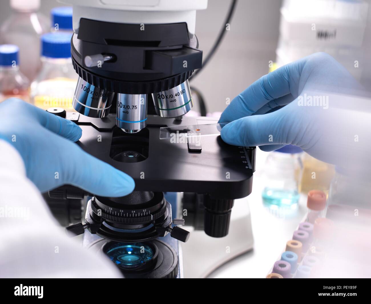 Gros plan d'un scientifique plaçant une diapositive contenant un échantillon humain sous un microscope optique pour des tests médicaux. Banque D'Images