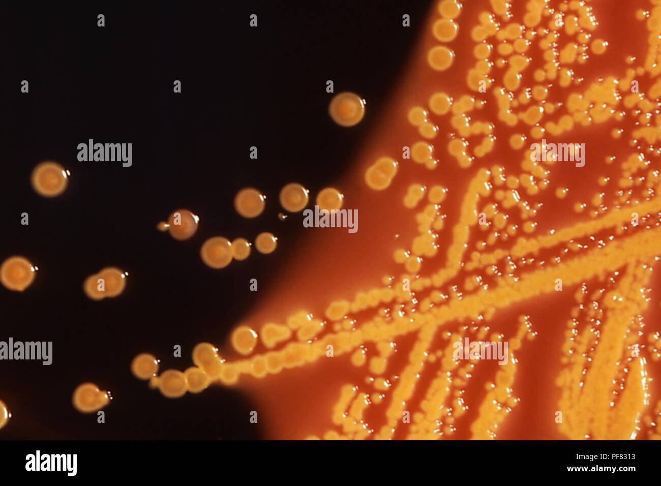 Les colonies de bactéries Escherichia coli cultivées sur un entérique Hektoen (IL) Gélose plate, 1976. Image courtoisie Centres for Disease Control (CDC). () Banque D'Images