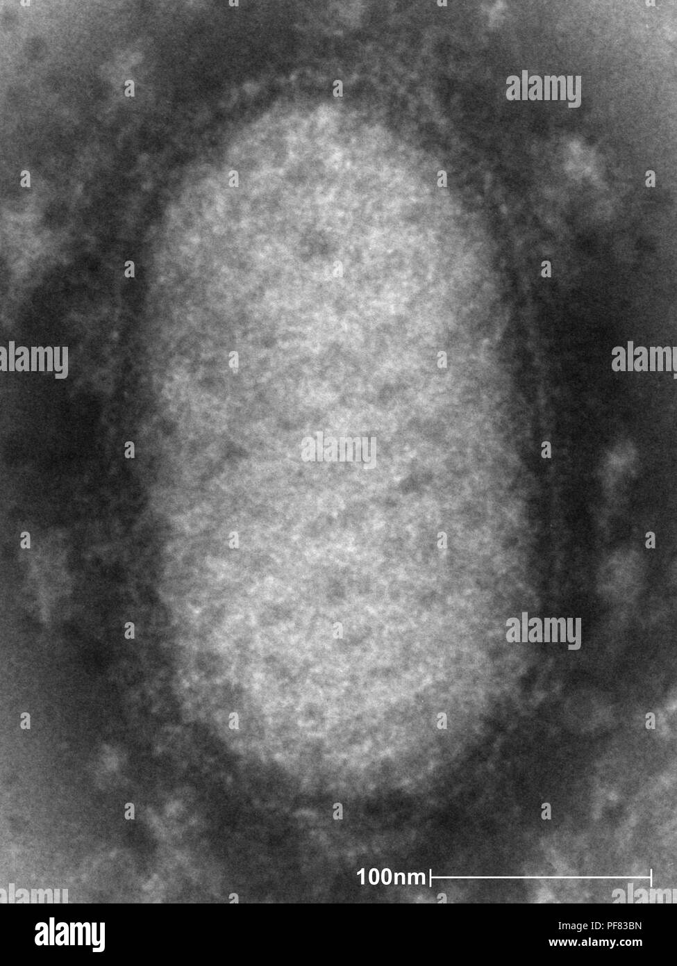 Détails de l'ultrastructure d'un virus de l'ORF a révélé par la négative, en microscopie électronique de transmission (TEM) de droit, 2004. Image courtoisie Centres for Disease Control (CDC) / Dr A. Likos. () Banque D'Images