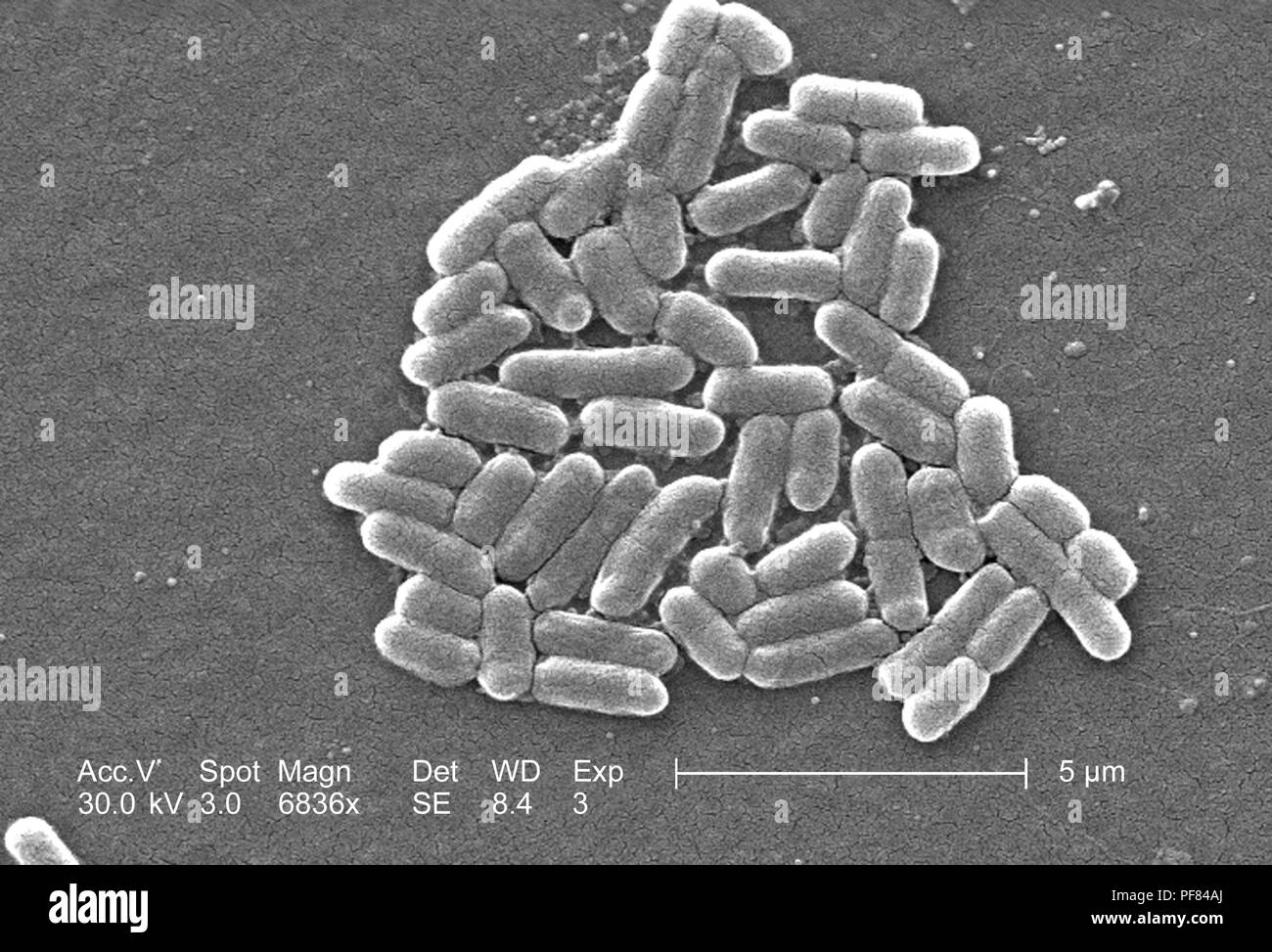Nombre de bactéries Gram négatif bactéries Escherichia coli de la souche O157:H7, révélé dans le 6836x amplifiés en microscopie électronique à balayage (MEB) de droit, 2006. Image courtoisie Centres for Disease Control (CDC) / National Escherichia, Shigella, Vibrio Unité de référence à la CDC. () Banque D'Images