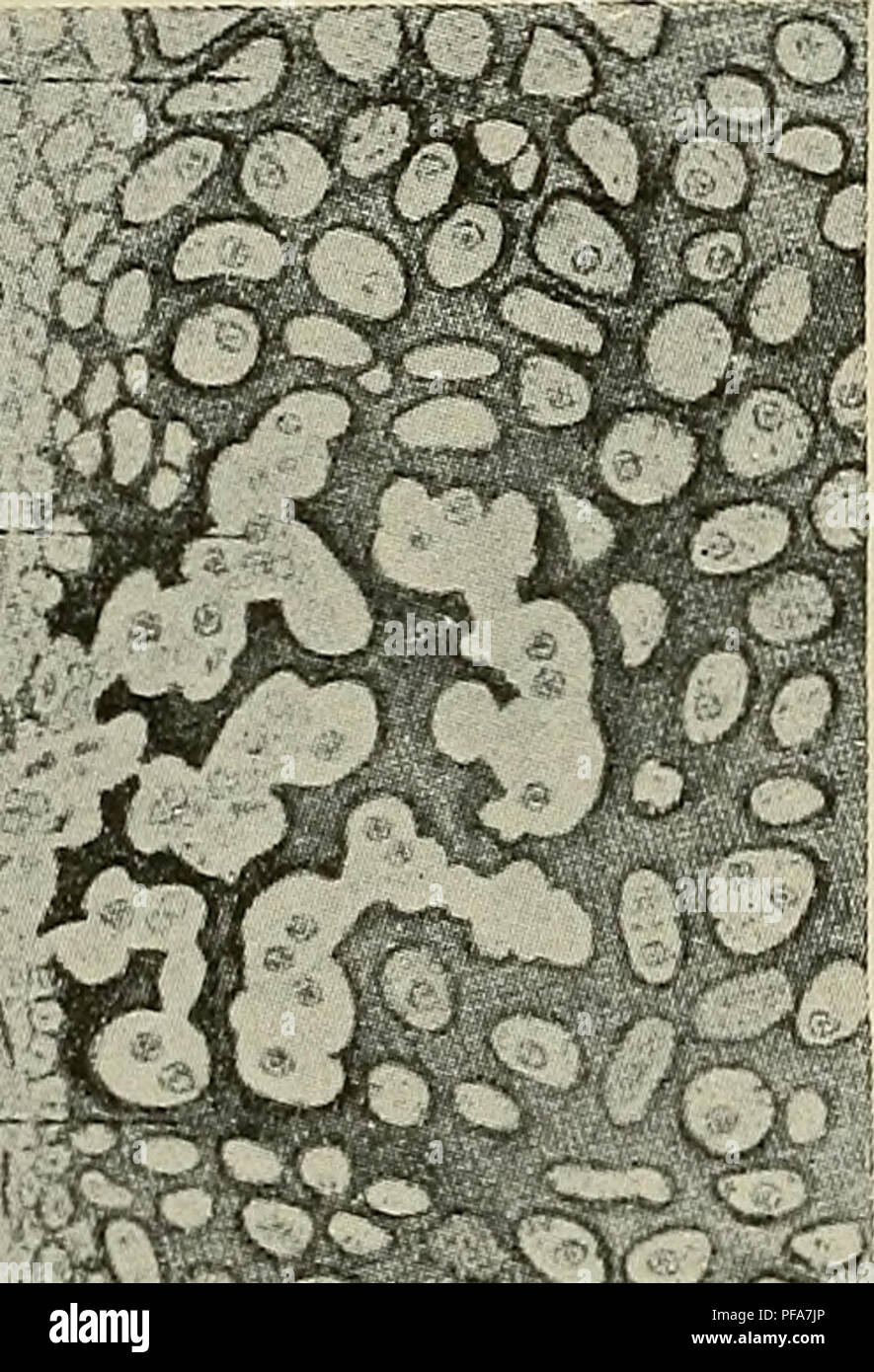 . Le développement de l'organisme humain : un manuel des droits de l'embryologie. L'embryologie ; embryon, Non-Mammalian. i56 Développement de pi po OS C ^ ;. dans un réseau grossier, les mailles d'qu'ils occupent pour former l'os maigow (m), et les ostéoblastes qui'ils contiennent eux-mêmes organiser sur la surface de la persistance et trabeculse-couches de l'os sur leurs surfaces. Dans l'intervalle, l'calcifica- tion de la matrice du cartilage a été l'extension, et plus rapide que le réseau d'trabeculse calcifié est formé il est envahi par les messines- chyme, jusqu'à ce que finalement le cartilage devient entièrement conver Banque D'Images