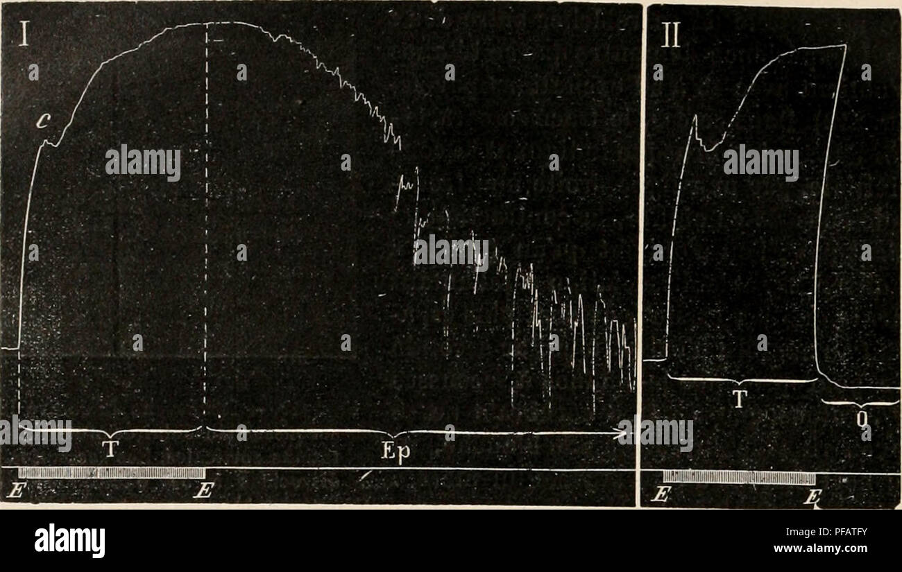 . Dictionnaire de physiologie. La physiologie. 478 EPILEPSIE CORTICALE. sans entre-croisement d'un certain nombre de fibres pyramidales vers la moelle ? Mais prÃ©- cisÃ©ment, chez le chien, la prÃ©sence du faisceau direct pyramidale est exceptionnelle, et c'est chez cet animal que les rÃ©actions bilatÃ©rales en question ont Ã©tÃ© observÃ©es. Et puis une expÃ©rience trà s¨exÃ©cutÃ simple©e, par F. Fra.xck, dÃ©montre pÃ©remptoirement que cette explication ne saurait Ãªtre acceptÃ©e. On peut pratiquer l'hÃ©misection- trans. FiG. 213. Â DifiÃ©rence des rÃ©actions motrices produced by l'excitation faib Banque D'Images