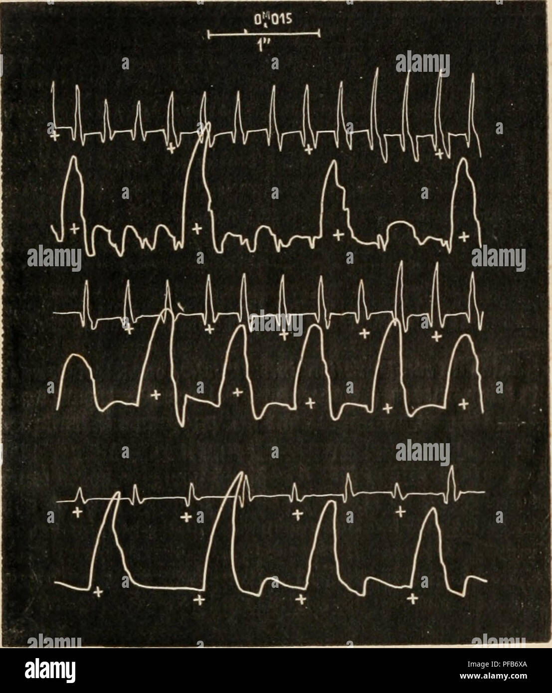 Ce dictionnaire de physiologie français explique le concept de période réfractaire dans le système nerveux, décrivant comment les excitations sont diminuées ou annulées pendant cette période. Il fournit un aperçu des processus physiologiques qui régissent la fonction et l'équilibre nerveux. Banque D'Images