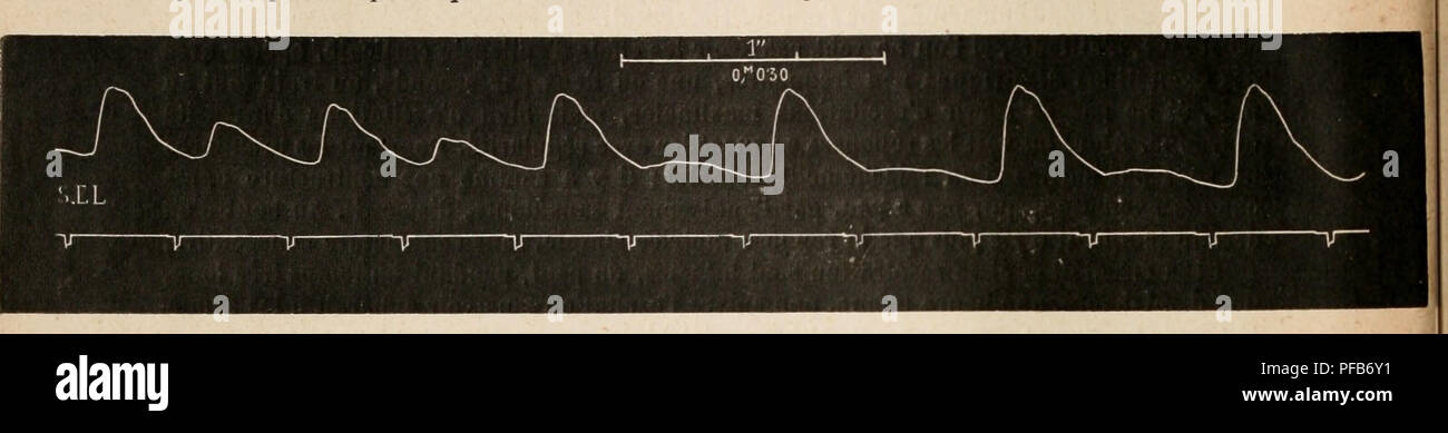 Ce dictionnaire physiologique couvre l'étude du cerveau et du système nerveux, décrivant les effets des stimuli excitateurs et leur impact sur la réponse du cerveau. Il comprend une terminologie scientifique détaillée liée à la fonction neurologique. Banque D'Images