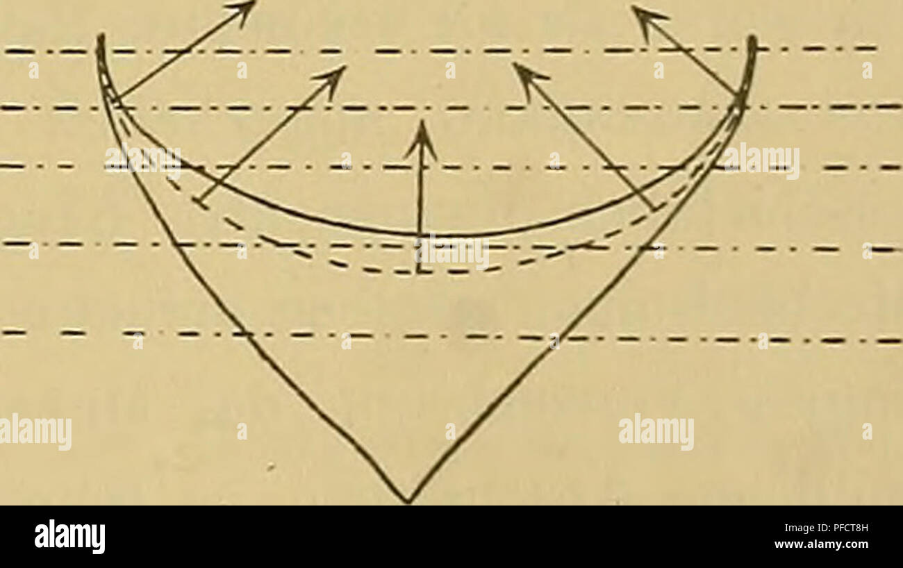 Ce travail académique explore le développement du troisième ventricule dans le cerveau humain, en se concentrant particulièrement sur son extension pariétale et son impact sur la structure cérébrale. Il met en évidence des avancées significatives en neuroanatomie et en recherche neurologique. Banque D'Images