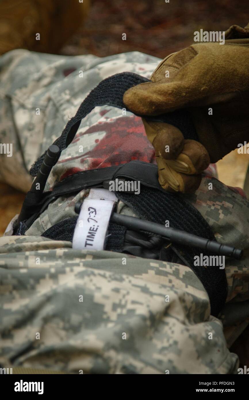 Un parachutiste de l'armée américaine attribuée à la Société A, 1er Bataillon, 325e Parachute Infantry Regiment, 82nd Airborne Division, applique un garrot sur une victime simulée sont placées le long de la Mile lors de la All American medical lane du 1er Sgt. Exercice de préparation au déploiement d'urgence Funk à Fort Bragg, Caroline du Nord, le 16 juin 2018. L'EDRE évalue et détermine la préparation au combat d'une société en procédant à partir d'un certain groupe de tâches, d'inclure l'éventail de qualifications, médicaux, et les évaluations de la condition physique. Banque D'Images