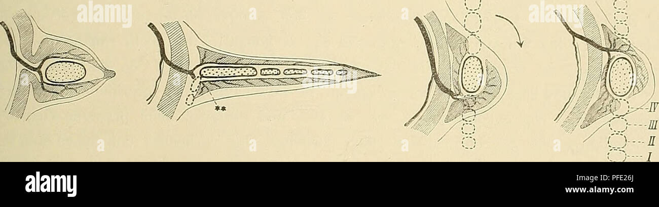 . Medicinisch-Naturwissenschaftlichen Denkschriften der Gesellschaft zu Jena. iöo. Die Muskeln und der Nerven. Ceratodusflosse 28l Knorpelskelets, die nach oben und nach unten schwächeren zahlreicheren dorsalen Muskeln, die nach innen (medialwärts) und die ventralen nach aussen (lateralwärts) zu liegen kommen (Textfigur 24c). Possibilité Die andere ist die, dass der gerade umgekehrt präaxiale ventralwärts wendet sich Rand, die starken Seitenradien dorsalen nach oben und die Muskeln nach aussen schauen (Textfigur 24a). Arten der Beide Bewegungen sind in der que ausgeführt worden, und die se termine Banque D'Images