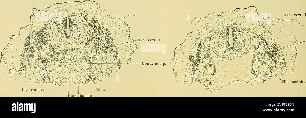 . Medicinisch-Naturwissenschaftlichen Denkschriften der Gesellschaft zu Jena. Sont. vert. II Ggl. spin. H - Hypochord. Sp. Vert. J Fig. IO. Fig. II. Sont. vert. I. N. spin. J Fig. 8. Schnitt durch den KÃ¶hypochordale rper, die Spange und die Wurzeln der Bogen des ersten Wirbels. Serie 44, Objtr. 3, 8, 7 Reihe Schnitt. Vergr. 27 : 1. Fig. 9. Schnitt durch den vordersten WirbelkÃ¶des ersten Theil (tanières rpers), die Bogen und den Wirbels des ersten Theil der hintersten delbasis¤Schüller. Serie 44, Objtr. 3, 7, 6 Reihe Schnitt. Vergr. 27:1. Der erste WirbelkÃ¶rper ist noch quer, die Schüller 2004-2005 delbasis horizont Banque D'Images