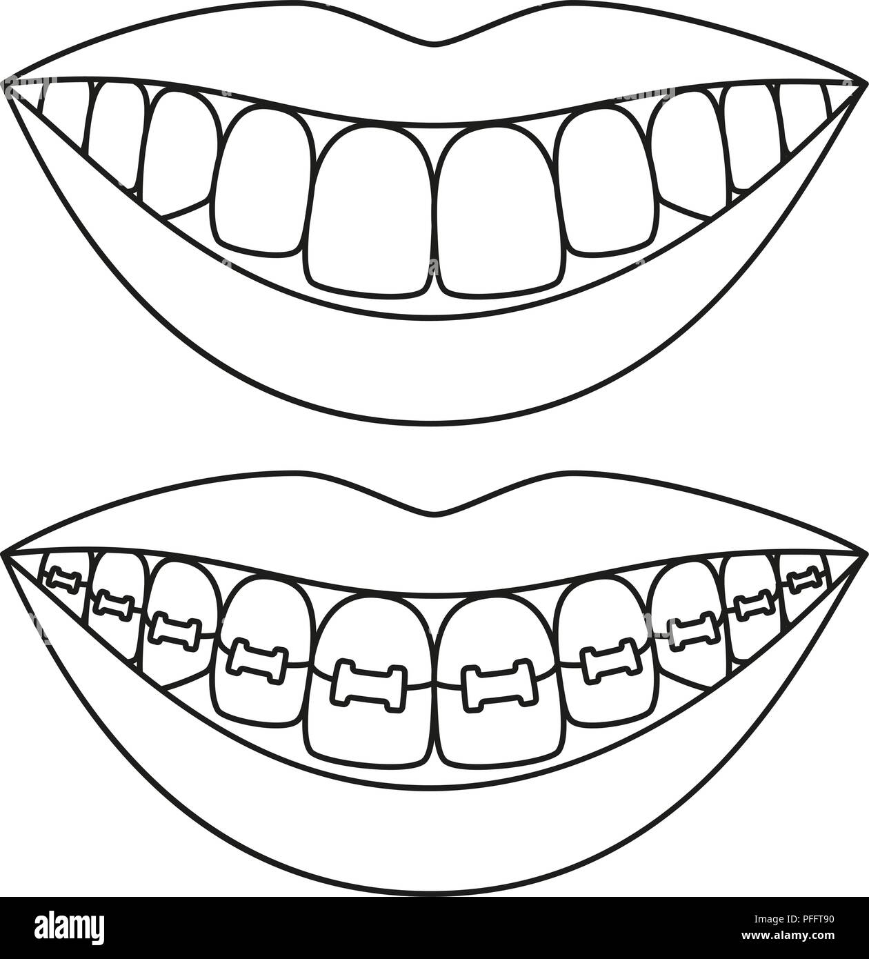 Noir Et Blanc D Art De La Ligne De L Alignement Des Dents Concept Image Vectorielle Stock Alamy Noir Et Blanc D Art De La Ligne De L Alignement Des Dents Concept Image Vectorielle Stock Alamy