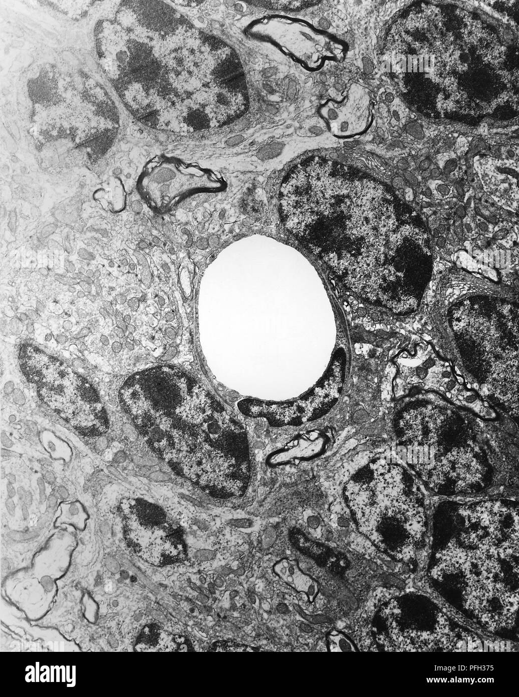 Vue en coupe d'un cerveau de souris normales et non infecté de perfusion capillaire-fixé à une tension artérielle normale, révélé dans la microscopie électronique de transmission (TEM) de droit, 1978. Image courtoisie Centres for Disease Control (CDC) / Dr Ed Ewing. () Banque D'Images