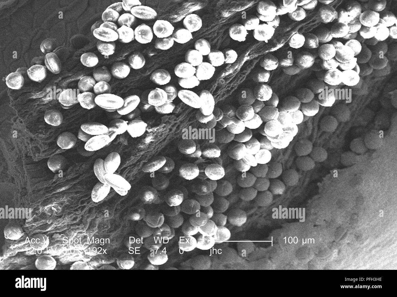 Les granules de pollen d'ultrastructure morphologique trouvé sur une 'jaune' artifice sundrops, Oenothera fruticosa fleur, révélé dans l'192x au microscope électronique à balayage grossie (SEM) de droit, 2006. Image courtoisie Centres for Disease Control (CDC) / Janice Haney Carr, Betsy grue. () Banque D'Images