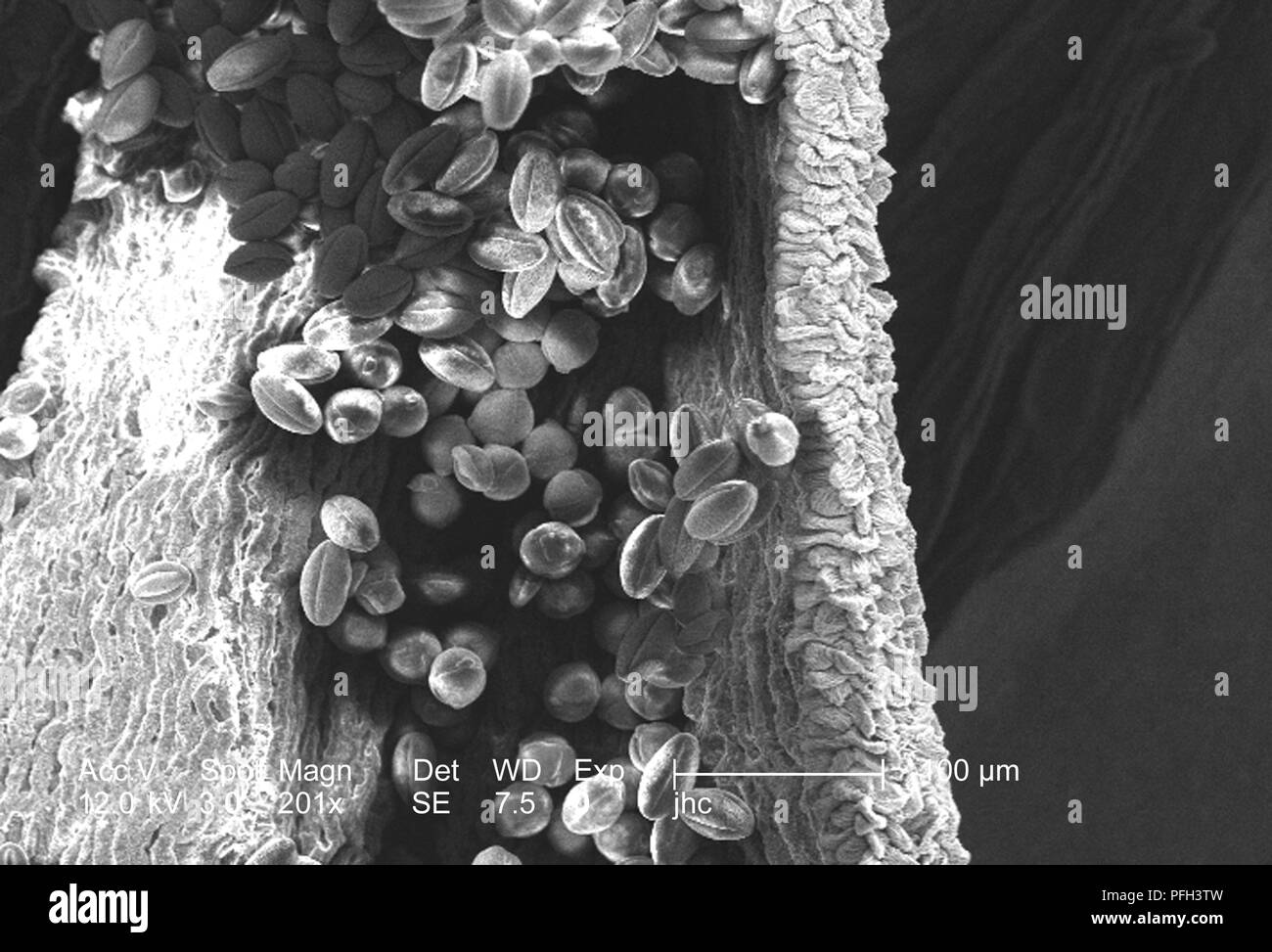 Les granules de pollen d'ultrastructure morphologique trouvé sur une 'jaune' artifice sundrops, Oenothera fruticosa fleur, révélé dans l'201x au microscope électronique à balayage grossie (SEM) de droit, 2006. Image courtoisie Centres for Disease Control (CDC) / Janice Haney Carr, Betsy grue. () Banque D'Images