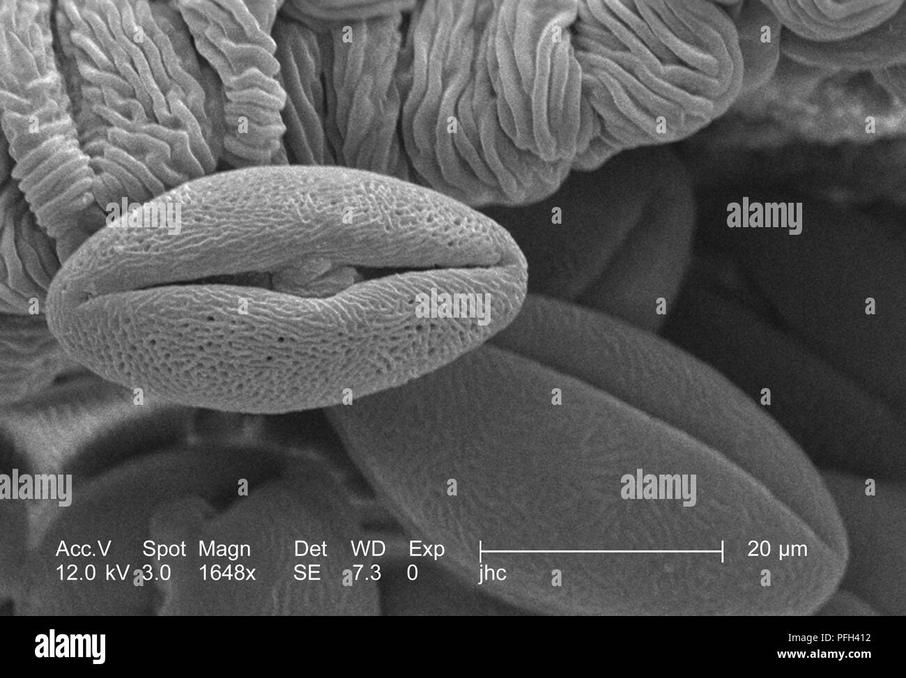 L'ultrastructure morphologiques des grains de pollen trouvés sur un 'jaune' artifice sundrops, Oenothera fruticosa fleur, révélé dans le 1648x amplifiés en microscopie électronique à balayage (MEB) de droit, 2006. Image courtoisie Centres for Disease Control (CDC) / Janice Haney Carr, Betsy grue. () Banque D'Images