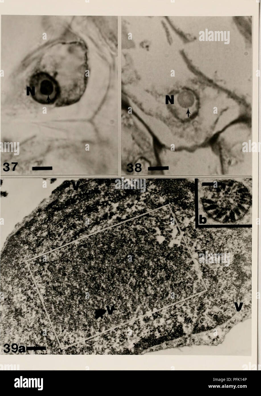 . Les méthodes cytologiques pour la détection, l'identification et la caractérisation des virus d'orchidées et de leurs corps d'inclusion. Orchidées, les maladies virales des plantes. -45-. Figure 37. La figure 38. Figure 39. Microphotographie lumière o induite par une cellule de rhabd colorées avec Light micrograph o induite par un rhabd (0,5 /m d'épaisseur) de N:Noyau. Bar  = un électron) microg Brassia rhabdoviru indique l'emplacement Bar  = 550 nm. b) spokewheel aggrega Bar  = 225 nm. f inclusion nucléaire (flèche) ovirus en Brassia leaf O/G. NrNucleus. Bar  = 5 /h. f inclusion nucléaire (flèche) ovirus en section semithin Brassia leaf cell. 5 raph jum. Banque D'Images