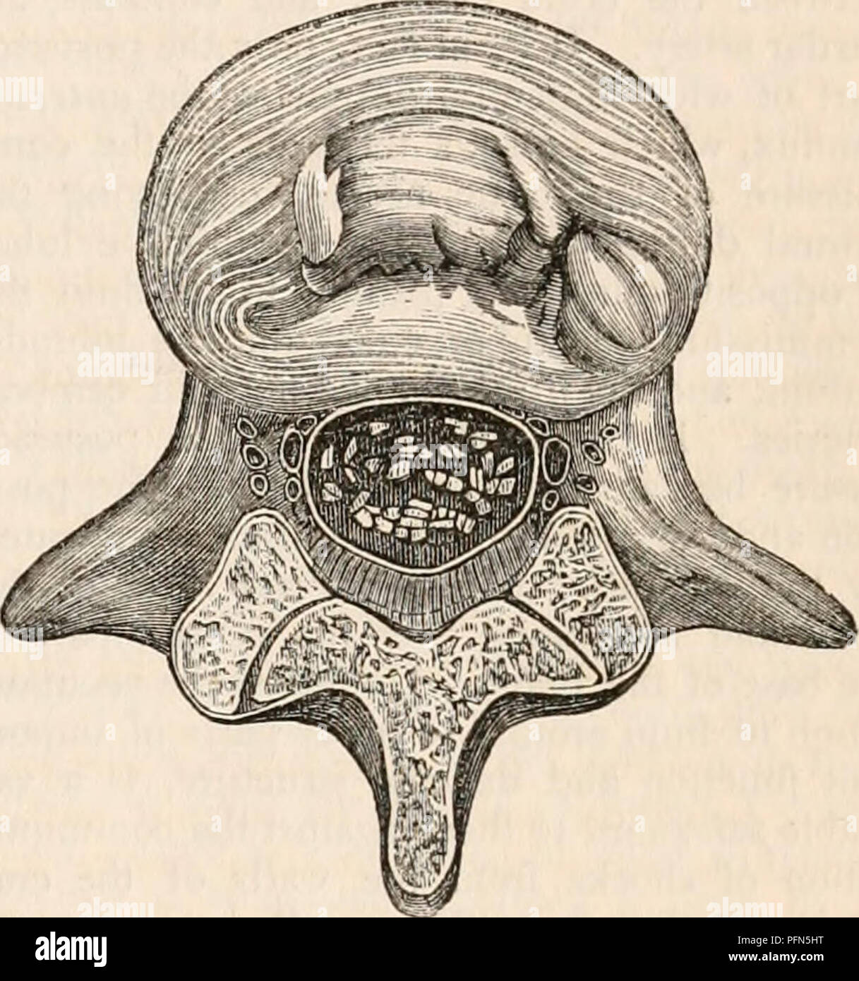 . La cyclopaedia d'anatomie et physiologie. Anatomie ; physiologie ; Zoologie. B. Articles de la colonne vertébrale dans la région lombaire. Une montre, la section du cordon, ainsi que de nombreuses racines des nerfs en ordre décroissant pour former la cauda equina. R, la montre de la cauda equina. Dans ces deux régions, l'espace sous-arachnoïdien est vaste et continu par des bandes ou des cloisons. Le fluide pénètre entre les racines de l'entoure et les nerfs de shion. Ouverture de la tête avant de la colonne vertébrale, ce qui a favorisé la fuite du fluide. Cet anatomiste était également conscient que le liquide a été formé et contenues dans la sous-arachnoi Banque D'Images