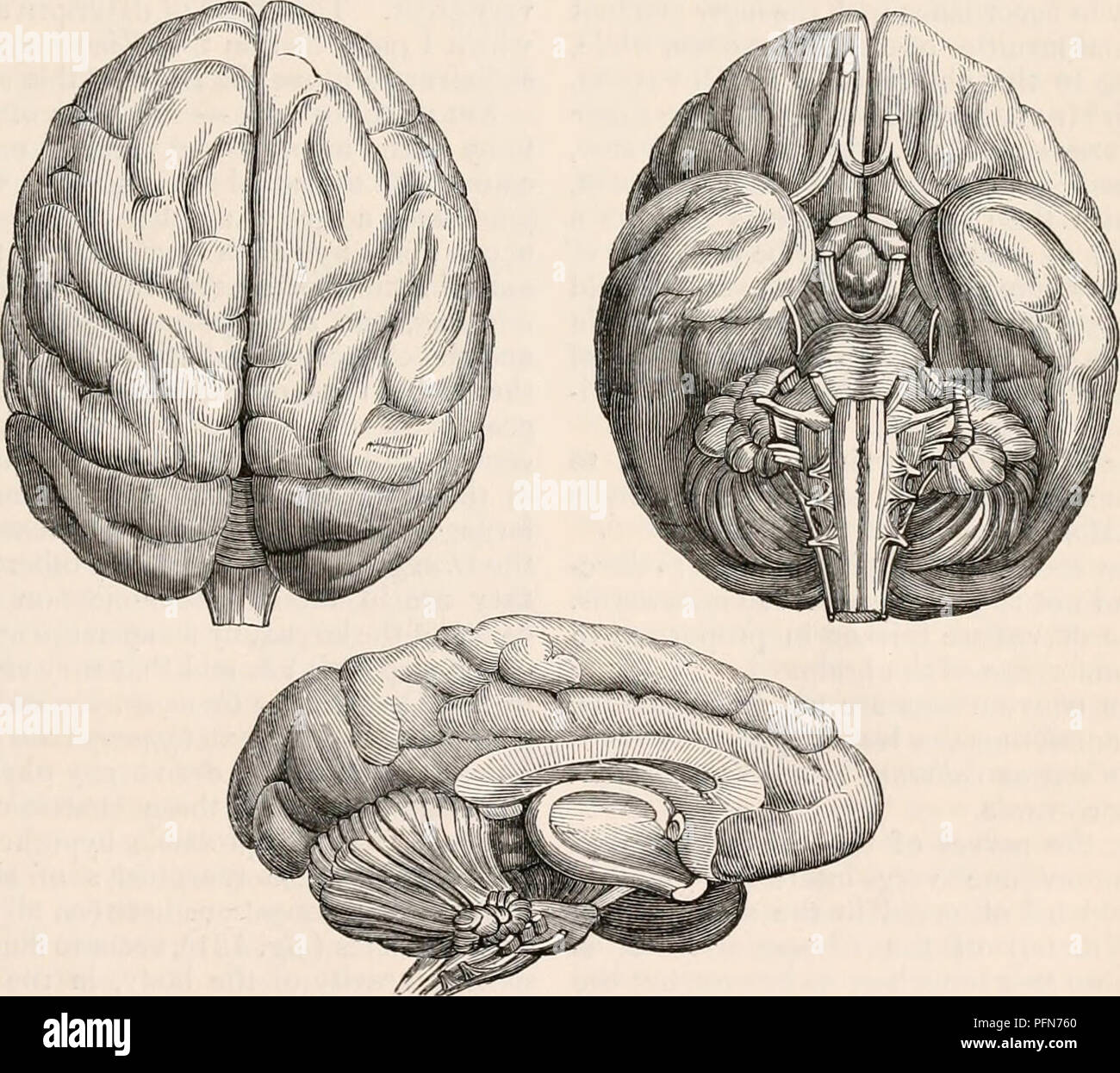 Présentation d'un cerveau de fœtus de chimpanzé - Persée