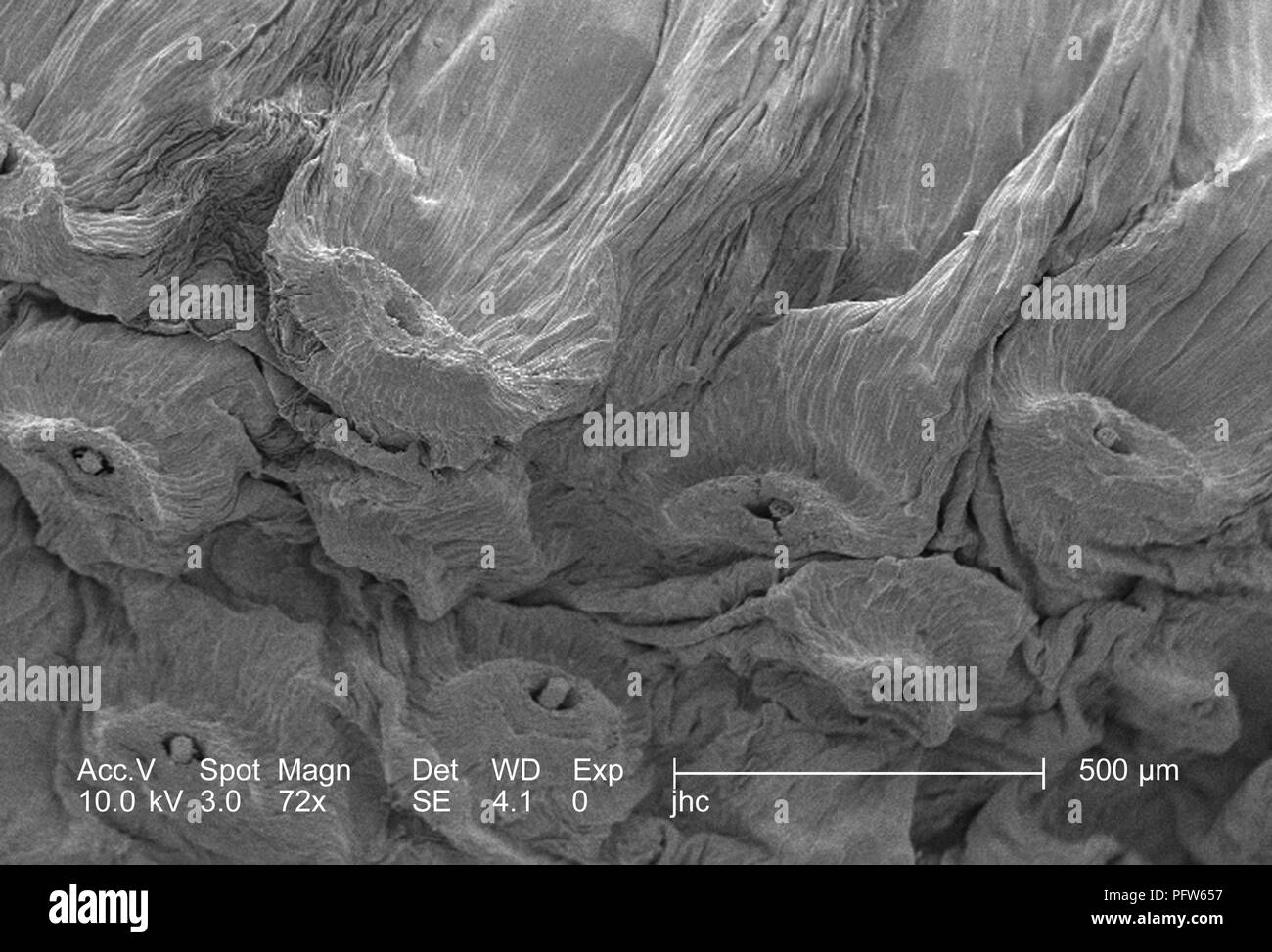 Surface morphologiques caractéristiques d'un 'dandelion réveil' à partir d'un Pissenlit (Taraxacum officinale Plante), représentés dans le 72x amplifiés en microscopie électronique à balayage (MEB) de droit, 2006. Image courtoisie Centres for Disease Control (CDC) / Janice Haney Carr. () Banque D'Images