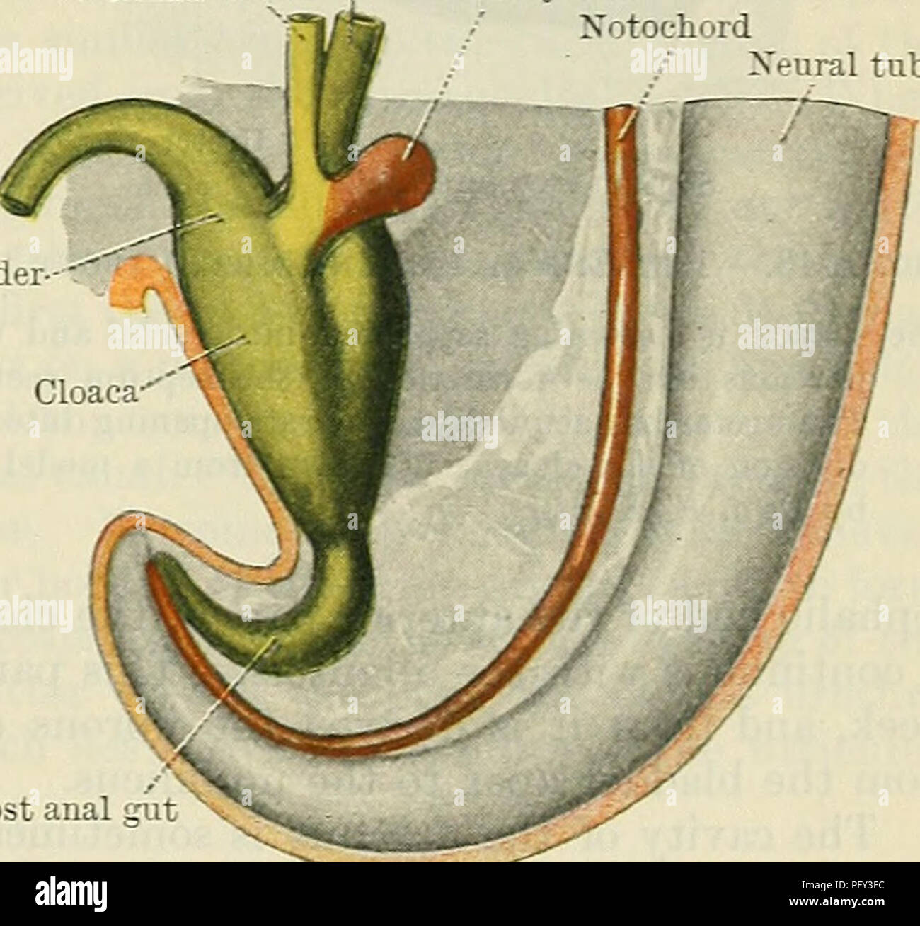 Histologie Du Kyste Du Canal Gartner