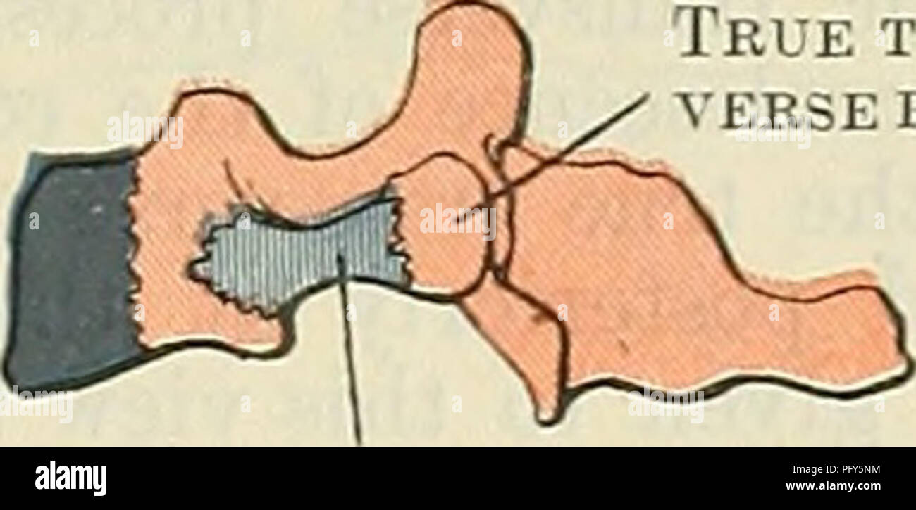 . Cunningham's Text-book de l'anatomie. L'anatomie. Vrai DU COL DE L'apophyse transverse Foramen trans- versarium : processus Costal ' suture centrale neuro-Foramen transversarium processus transverse. Vrai trans- verset processus. Veuillez noter que ces images sont extraites de la page numérisée des images qui peuvent avoir été retouchées numériquement pour plus de lisibilité - coloration et l'aspect de ces illustrations ne peut pas parfaitement ressembler à l'œuvre originale.. Cunningham, D. J. (Daniel Jean), 1850-1909 ; Robinson, Arthur, b. 1862, éd. New York, W. Wood Banque D'Images