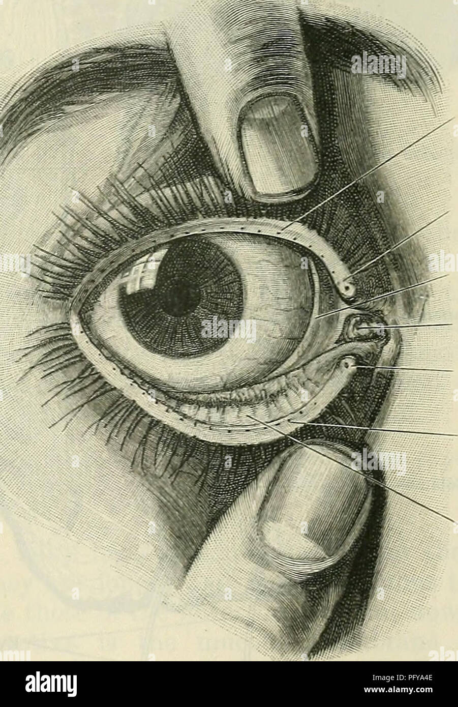 . Cunningham's Text-book de l'anatomie. L'anatomie. Les paupières. 821 oculi à l'avant et l'antérieure oculi caméra derrière postérieure. Ces sont remplis de l'humeur aqueuse, et, dans l'adulte, de communiquer librement à travers l'ouverture de l'élève, mais dans le foetus sont séparés par la membrane pupillaris. La caméra de la chambre antérieure antérieure ou oculi est délimité en avant par la cornée, l'iris et par derrière, tandis que l'objectif de façon périphérique il communique avec la spatia anguli iridis. L'appareil photo oculi postérieur ou chambre postérieure est triangulaire sur l'article, et est délimitée à l'avant par le j Banque D'Images