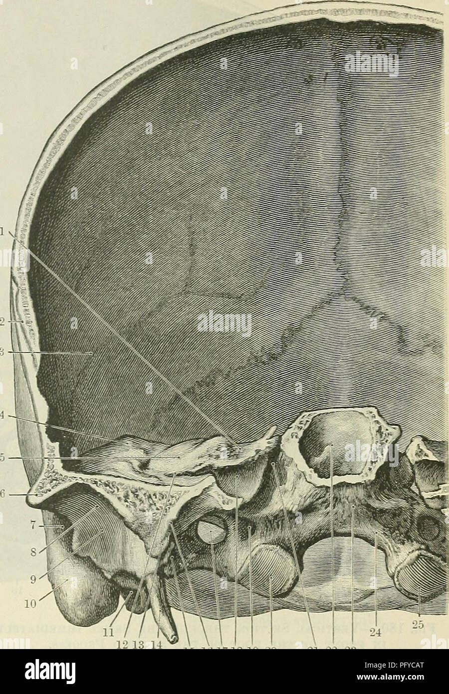 . Cunningham's Text-book de l'anatomie. L'anatomie. CEANIUM FKONTAL ARTICLES DE LA. 191 La figure suivante (Fig. 179) affiche la surface antérieure de l'article juste derrière que décrit ci-dessus. Dans le centre est considéré le corps du sphenoid, et la paroi postérieure du sinus est maintenant exposée ; d'un côté ou de l'apex de la partie petrous de la contiguïté temporelle sur le côté du corps du sphenoid, et le grand orifice de la canal carotidien est vu ouvrant sur la paroi postérieure du foramen lacerum, qui est ici divisé. Dans le renfoncement situé entre la paroi latérale du canal carotidien et Banque D'Images