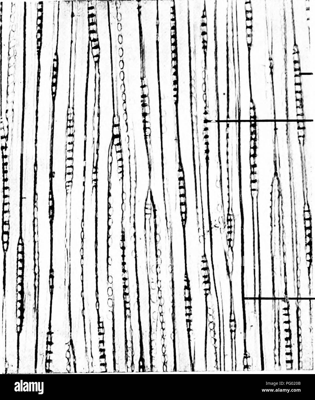 . Photomicrographies de études botaniques. La photomicrographie. ledullary rayons. Aréolées. Cell-wall en vue radiale. 67. T.L S. Tige (bois) " Pinus sylvestris/' pin commun.. 3- dans la section des rayons médullaires. si- aréolées dans les sections. Cell-wall en vue tangentielle.. Veuillez noter que ces images sont extraites de la page numérisée des images qui peuvent avoir été retouchées numériquement pour plus de lisibilité - coloration et l'aspect de ces illustrations ne peut pas parfaitement ressembler à l'œuvre originale.. Flatters, Milborne &AMP ; McKechnie Ltd. Manchester : Flaters, Milborne &AMP ; McKechnie Banque D'Images