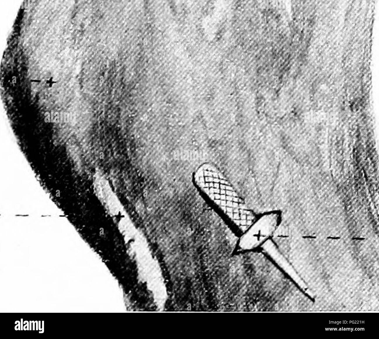 Ce guide anatomique fournit des illustrations détaillées des structures internes du cheval, en se concentrant sur les aspects chirurgicaux. Il sert de ressource clé pour les vétérinaires et ceux qui étudient l'anatomie équine, illustrant les systèmes musculaires, osseux et organiques cruciaux pertinents pour la chirurgie et la médecine vétérinaire. Banque D'Images