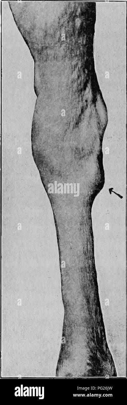 . Les maladies des animaux ; un livre de mémoire et des conseils populaires sur les soins et les problèmes de santé des animaux de ferme. La médecine vétérinaire, des animaux domestiques. 230 Les maladies des animaux aussi haut que possible, puis de le maintenir dans cette position pendant quelques minutes, puis le cheval est lancé à la fois dans un trot, la boiterie seront trouvés à être plus sévère. Un examen attentif de l'intérieur du jarret-joint, soit par sentiment ou en le comparant avec l'autre, va montrer un agrandir- ment, ou groupe, qui peuvent varier en taille, en fonction de circonstances. La taille de la botte n'indique pas la se Banque D'Images