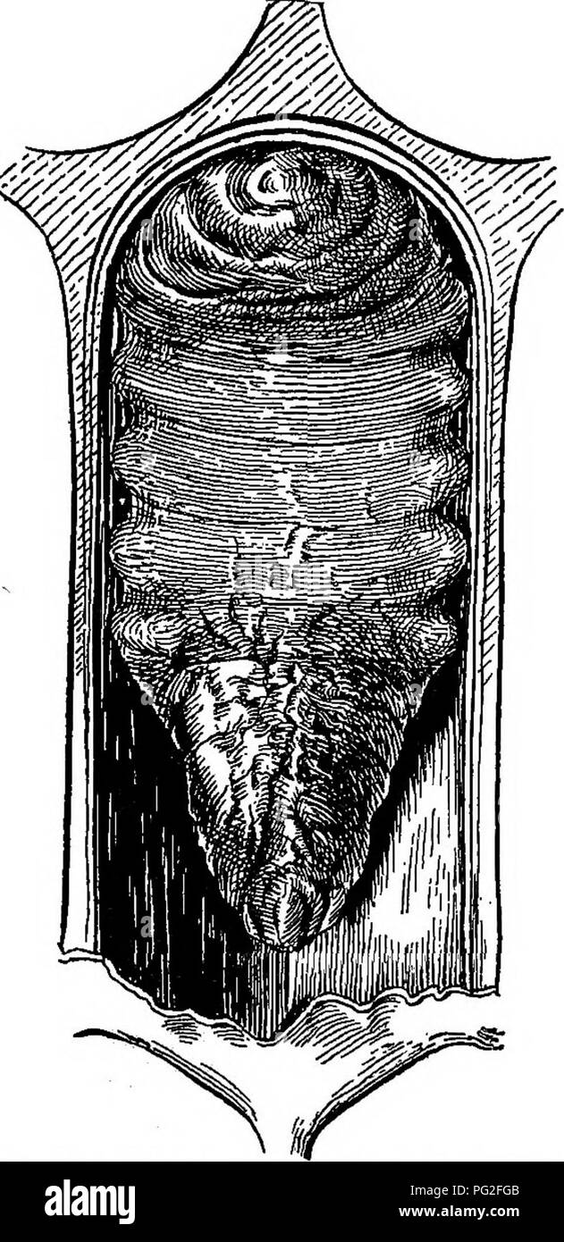 . Couvain sacciforme. Les abeilles. SACBEOOD. 17 La surface ventrale de ces deux tiers (fig. 16, PI. II, o) est moins con- vex d'un côté à l'autre. Les crêtes et sillons, représentant les seg- ments, sont moins prononcées. Les marges latérales sont stiU entaille profonde. L'angle de vue sur la face ventrale de la santé d'une larve, à la jonction des tiers moyen et postérieur, a donné lieu à un plus grand un dans ce stade de décomposition. Le fluide subcuticulaire claire à fréquemment observés. les marges latéraux et postérieurs de lar- vae morts de cette maladie est ici augmenté en quantité. La cohérence du contenu de Banque D'Images