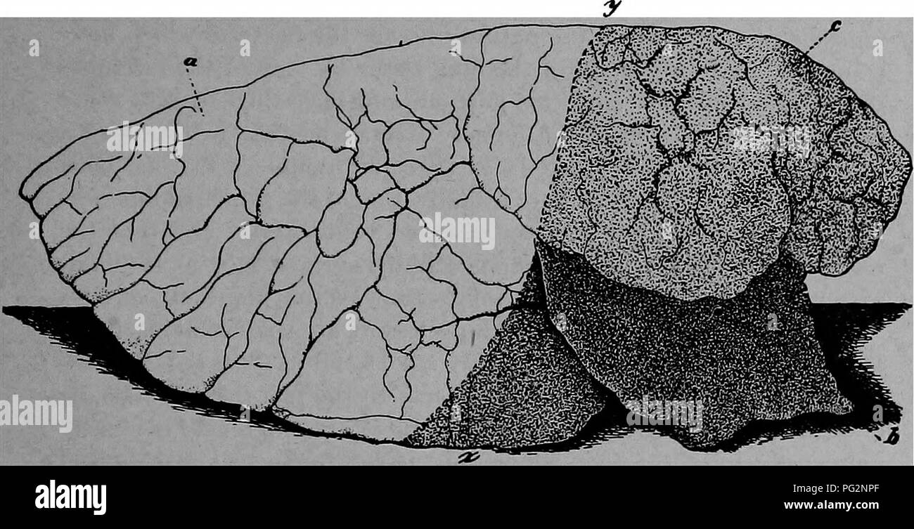 . La pathologie et le diagnostic différentiel des maladies infectieuses des animaux : préparé pour les étudiants et les praticiens de médecine vétérinaire . La médecine vétérinaire ; les maladies transmissibles chez les animaux. Peste porcine 53 Deux types de pneumonie sont rencontrés, à savoir, et lobaire pneumonie broncho-ou catarrhale. Dans l'ancien la partie du poumon vésiculaire substance est principalement touchés ; dans ce dernier les petites bronchioles sont principalement attaqué et les alvéoles de façon secondaire. Dans croupous-pneumonie, il y a, à la suite de l'étape de la congestion, une émigration des globules rouges, des leucocytes, une Banque D'Images